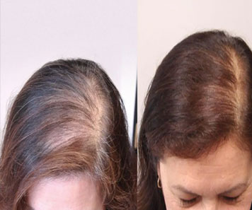 trichologist in bhubaneswar