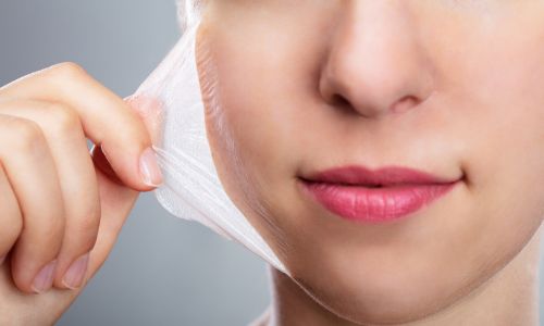 chemical peels in bhubaneswar