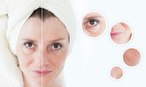Facial Rejuvenation in bhubaneswar
